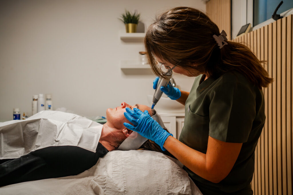 Dermapen Microneedling at Blissimo Skin & Body Clinic