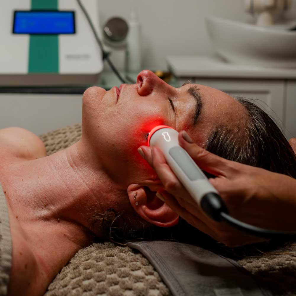 RF Facial Treatments at Blissimo Skin & Body Clinic