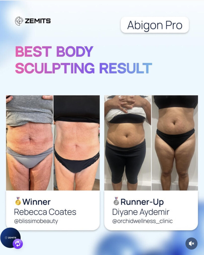 Zemits Abigon Pro's Best Body Sculpting Result - Winner